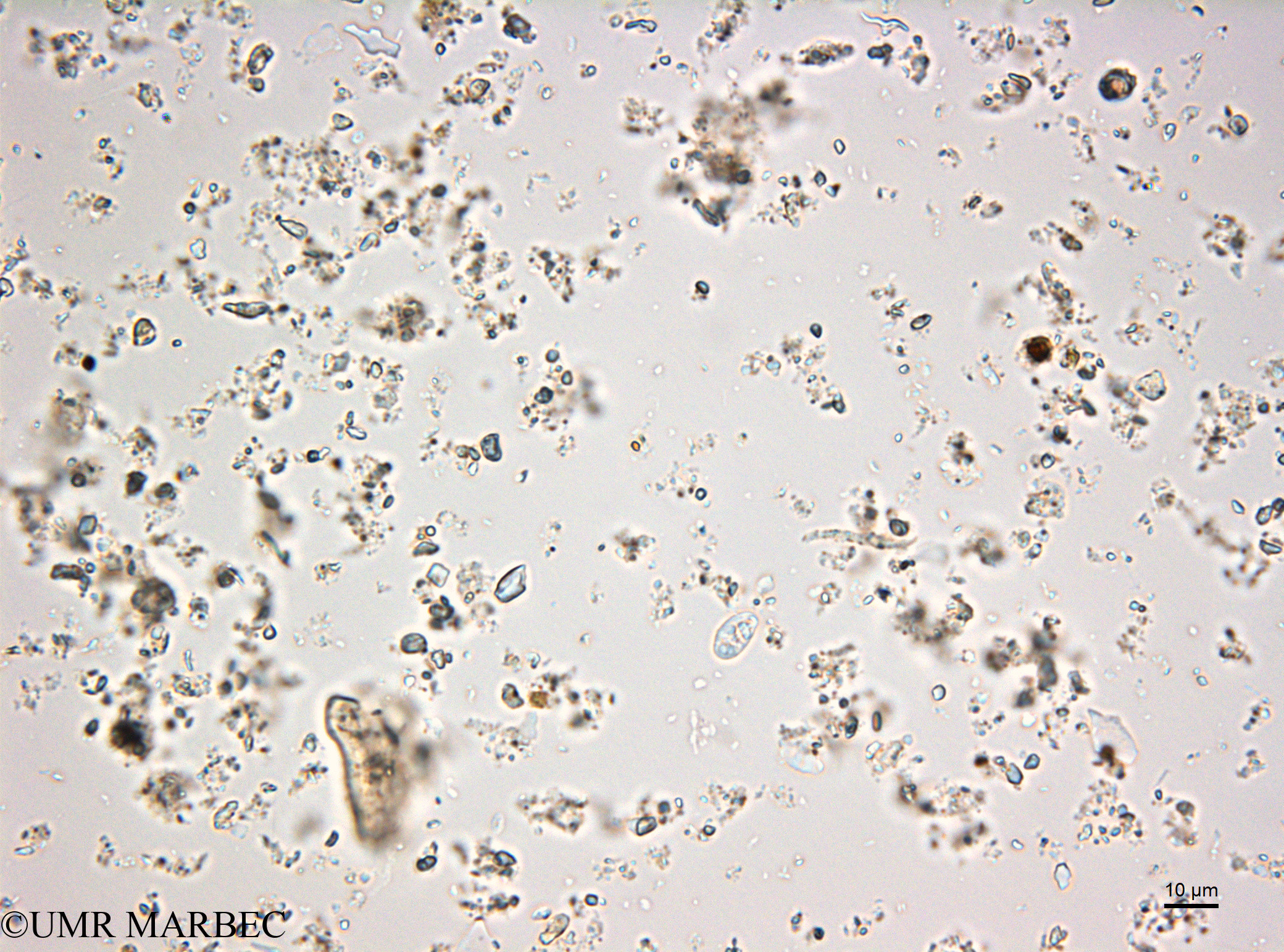 phyto/Bizerte/bizerte_lagoon/RISCO February 2015/Euglenoidea spp (ancien Elutriat_Euglenoidea160115_001_ovl-2.tif)(copy).jpg